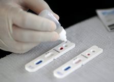 Anvisa libera testes rápidos de coronavírus em farmácias e drogarias
