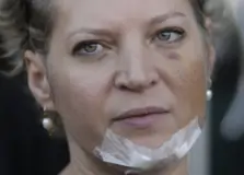 Polícia Civil conclui que Joice Hasselmann sofreu acidente e descarta agressão