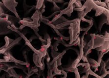 Variante americana da Covid-19 chama atenção pela letalidade