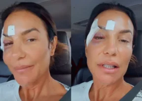 Ivete Sangalo recebe alta de hospital e tranquiliza fãs após internação em Salvador