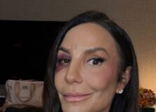 Ivete Sangalo retorna aos palcos após acidente doméstico