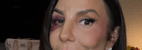 Ivete Sangalo retorna aos palcos após acidente doméstico