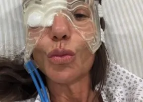Ivete Sangalo recebe alta após cirurgia no rosto