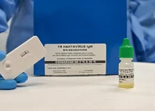 Paraná confirma casos de hantavírus; a infecção pode resultar em doenças graves